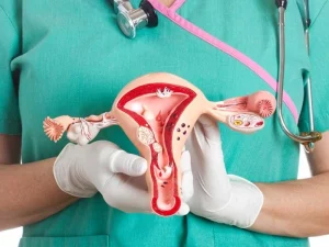 هیسترکتومی