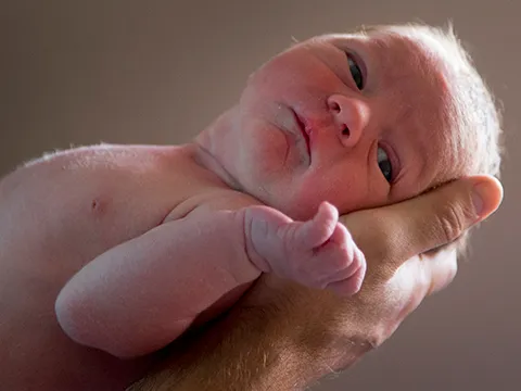 مزایا و معایب زایمان طبیعی بدون درد