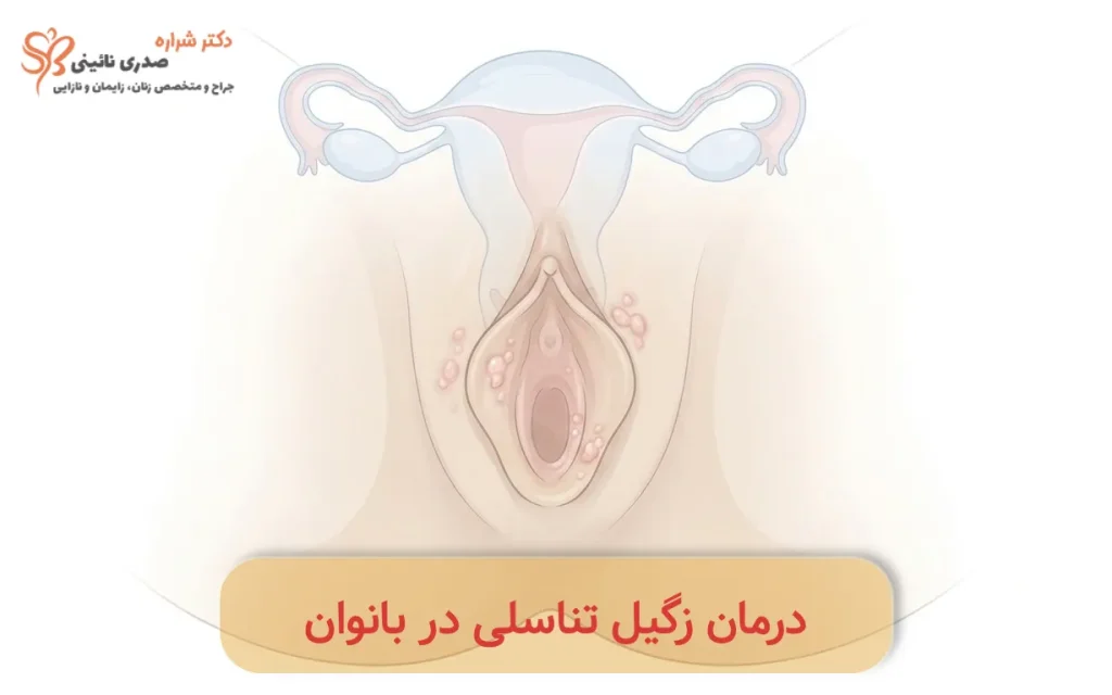 درمان زگیل تناسلی زنان