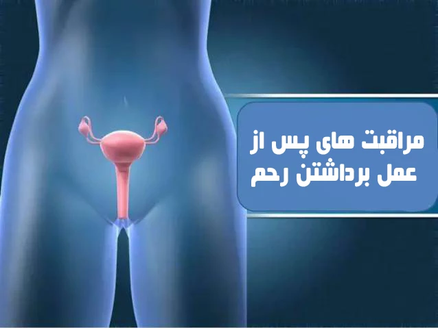 هیسترکتومی