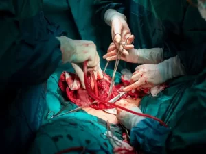 مراقبت های بعد از عمل هیسترکتومی