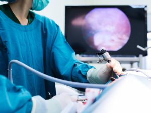 لاپاراسکوپی کیست تخمدان