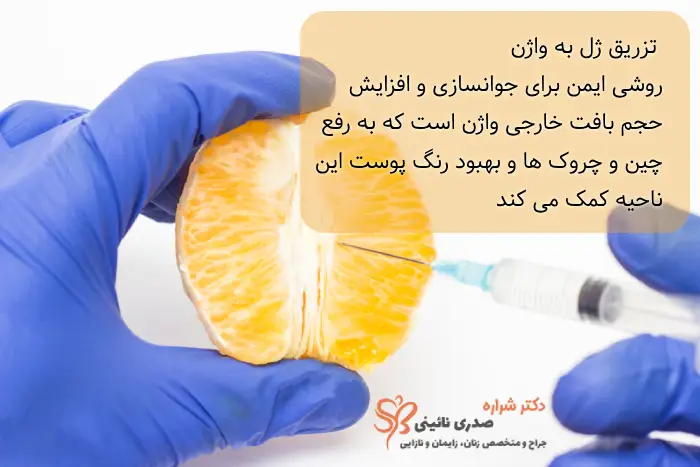 تزریق ژل به واژن