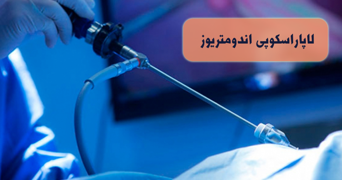 جراحی لاپاراسکوپی اندومتریوز لاپاراسکوپی اندومتریوز