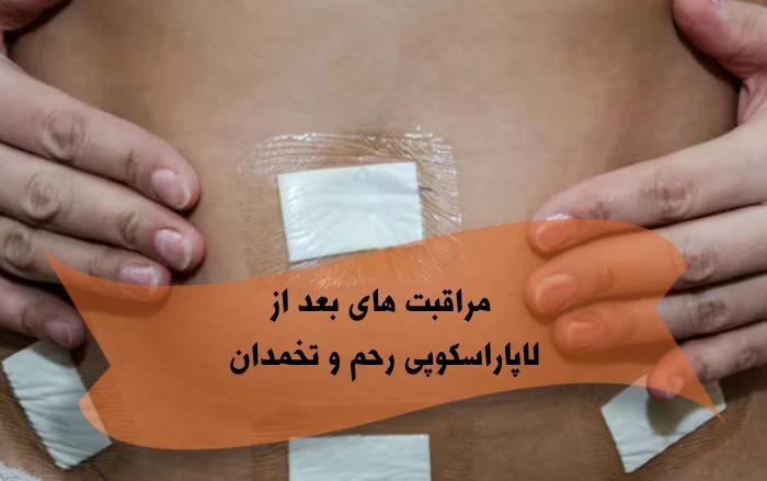مراقبت های بعد از لاپاراسکوپی رحم و تخمدان