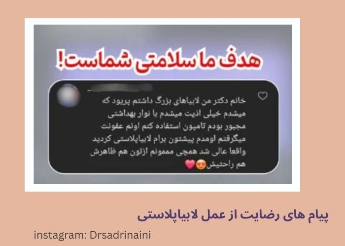 عکس رضایت بیمار از لابیاپلاستی