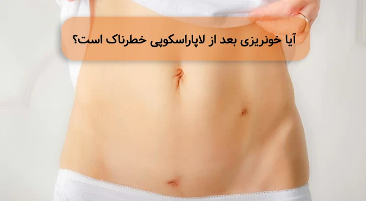 خونریزی بعد از لاپاراسکوپی