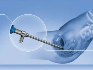 هیستروسکوپی