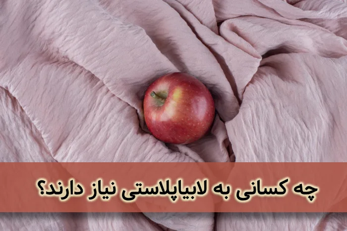 کاندیدای مناسب برای لابیاپلاستی