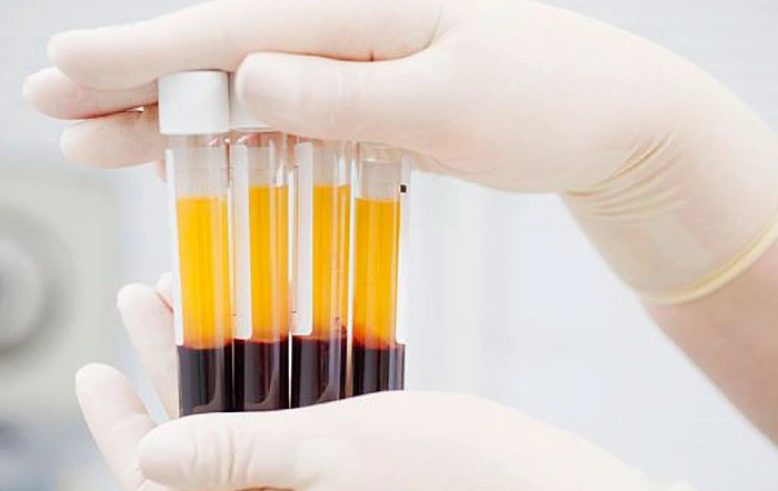 پلاسماتراپی واژن