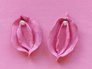 کاندیدای مناسب لابیاپلاستی