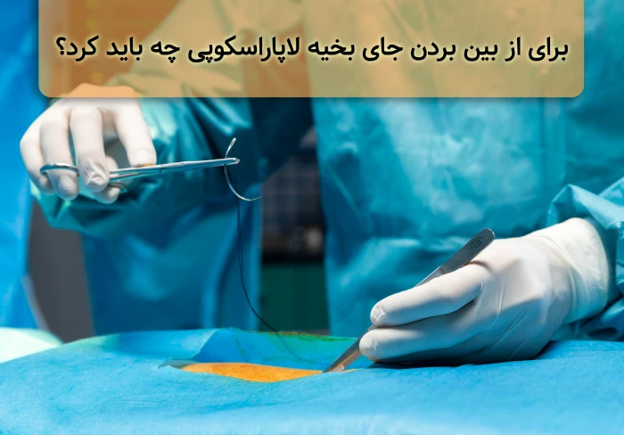 جای بخیه لاپاراسکوپی